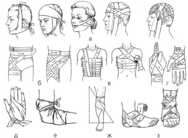 Виды перевязок и способы их наложения с картинками