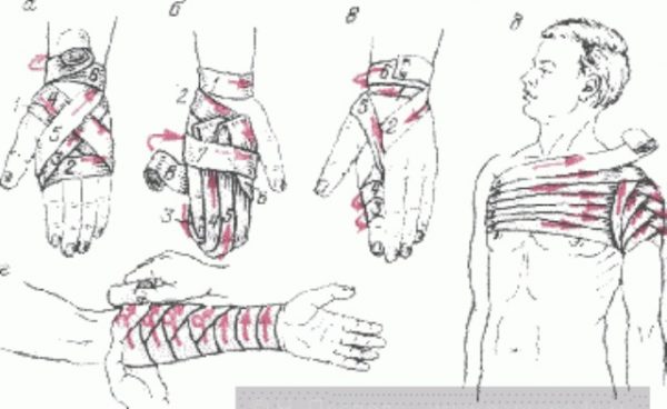 Виды повязок и способы их наложения с картинками для школьников