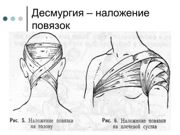 Повязки со схемой