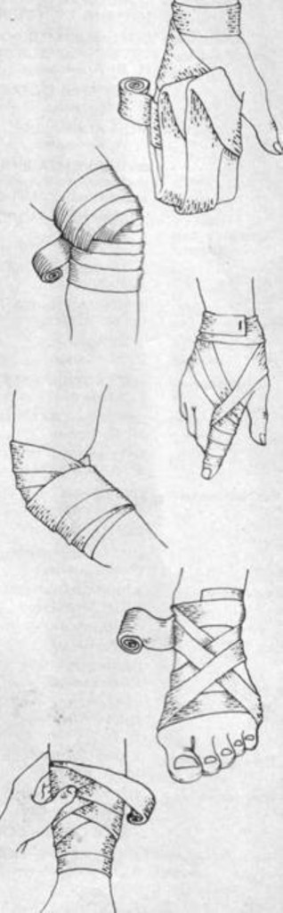 Как делать перевязку бинтом. Десмургия повязки на конечности. Колосовидная повязка на стопу. Повязки на ногу десмургия.