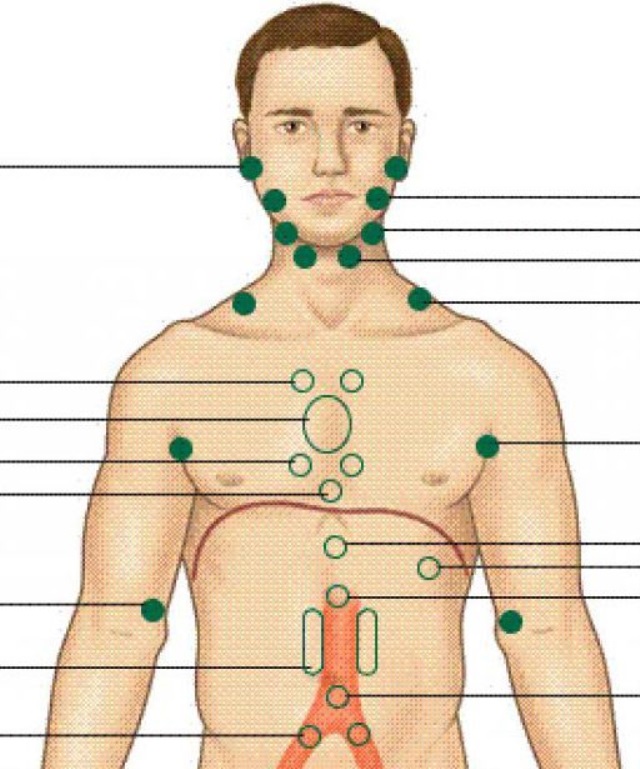 Лимфоузел справа у мужчины. Расположение лимф узлов. Лимфатические узлы расположение. Лимфатические узлы схема расположения. Места расположения лимфоузлов.