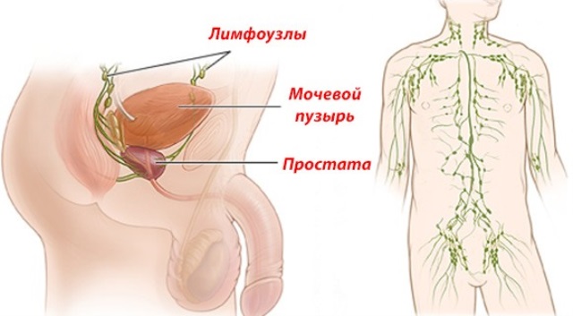 Пах человека. Паховые лимфоузлы расположение. Лимфоузлы у мужчин в паховой области расположение. Воспаленные лимфоузлы в паху. Воспалены паховый лимфоузлы.